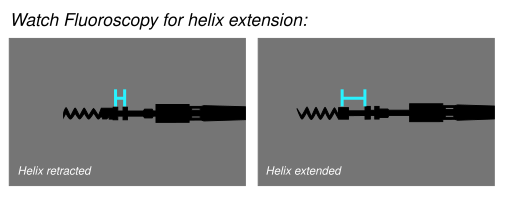 Helix-extension 5086-4076 Capsure fix novus.svg